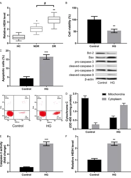 Figure 1. LncRNA HEIH was highly expressed in serum samples of patients with diabetic retinopathy (DR) (A) and high concentrations of D-glucose (HG) induced injury in APRE-19 cells