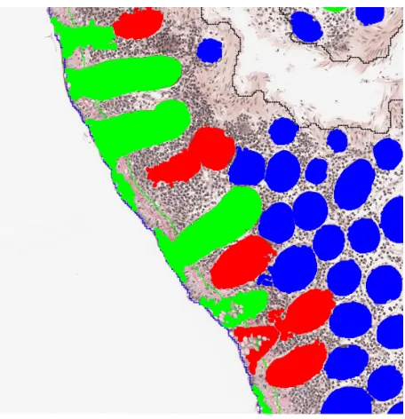 Figure 4 Identified crypts used to estimate the orientation of the biopsy. Notes: Green crypts are identified as being perpendicular, blue are tangential, and red with an unknown orientation.