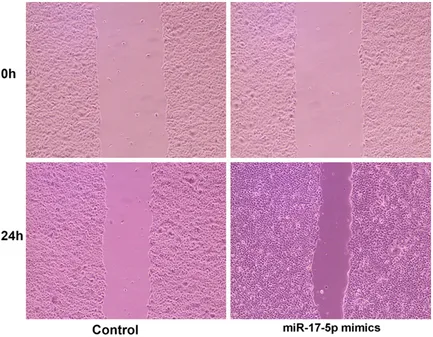 Figure 3. Overexpression of miR-17-5p promoted CAL-27 cell migration under hypoxia. CAL-27 cells were transfected with miR-17-5p mimics (50 nmol) or miRNA mimic negative control (50 nmol) under 1% O2, 94% N2, and 5% CO2 at 37°C for 24 h