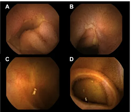 Table 2 Overall agreement (three levels) according to different sections of the gastrointestinal tract