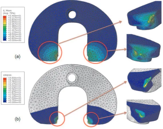 Fig. 8.The contour plot of the predicted (a) von Mises stresses and (b) contact pressure (MPa)at the tibial plateau.