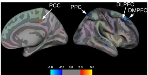 Table 3. Summary of Group Differences in Cortical Thickness.