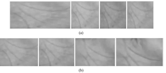 Figure 6. Extraction of ROI from palm image in COEP database: (a) Original palmprint image; (b) Color image converted into grayscale image; (c) ROI extraction; (d) Extracted palmprint