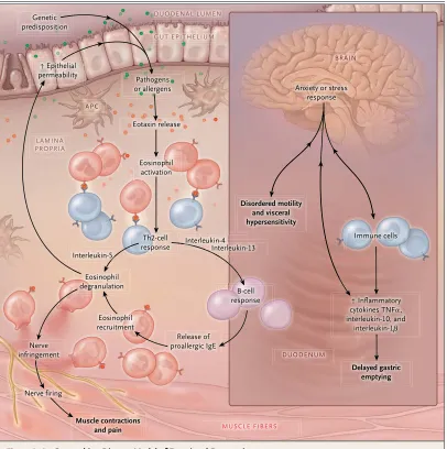 Figure 2. An Overarching Disease Model of Functional Dyspepsia.In the presence of a background genetic disposition, a type 2 helper T (Th2)–cell response may be activated in the duodenum, possibly by allergens or pathogens, which cross through the gut epit