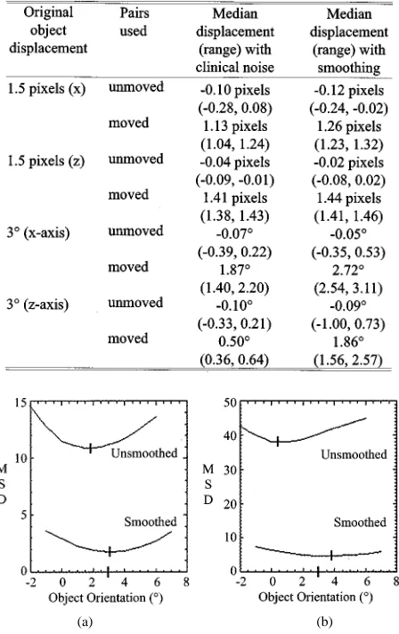 Fig. 6.Plots of MSD versus orientation of the reconstructed object for variouscontinuous rotational misalignments about the x-axis