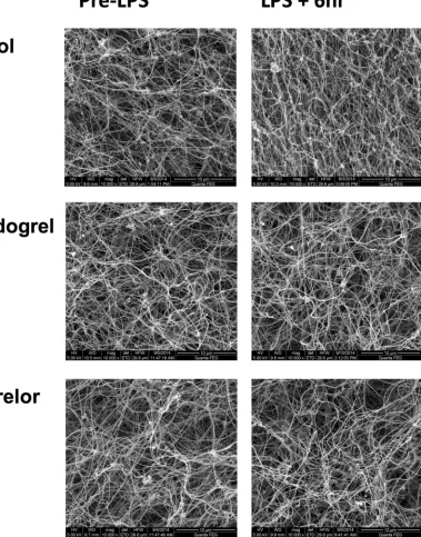 Figure 5. Representative electron microscope images of fibrin clots formed from plasma ex vivo Clots were prepared in duplicate and 4 photographs were taken of each clot at each time point