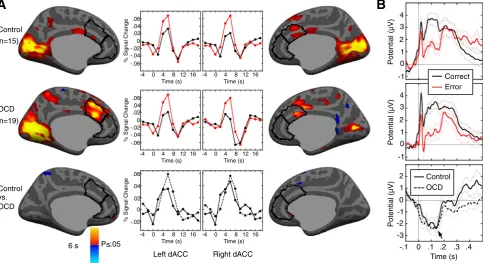 Fig. 2. Neural responses to error commission. A. Pseudocolor statistical maps of error-related fMRI activation at 6 s in the error vs