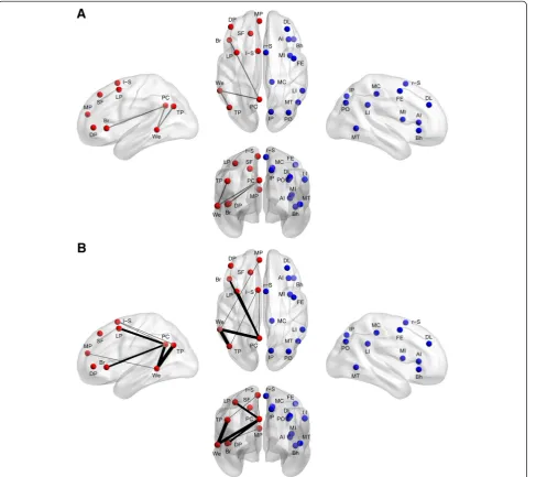 Figure 1 Lateralized hub locations and abnormally lateralized connections.participate in the most left- and right-lateralized connections, as determined in a separate sample of 1,011 typically developing subjects, aredisplayed on rendered brain images.cort
