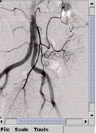 Figure 9: Screenshot from the Java lightweight client application (with DICOM viewer),running on a PDA