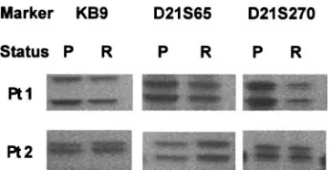 Figure 1. Polymorphic marker analysis in 2 AML patients at presentation (P)and relapse (R)