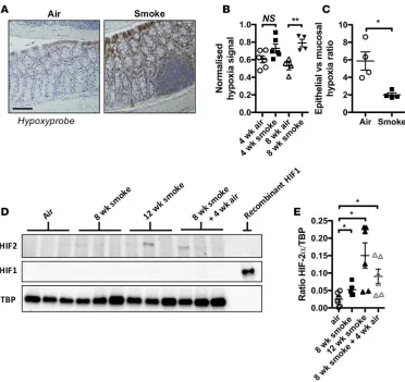 Figure 3. Chronic CS exposure triggers mucosal hypoxia and HIF-2 stabilization.stained positive for hypoxyprobe was determined, and the ratio of these 2 values was calculated, demonstrating a significant shift in hypoxyprobe staining to the mucosal layer o
