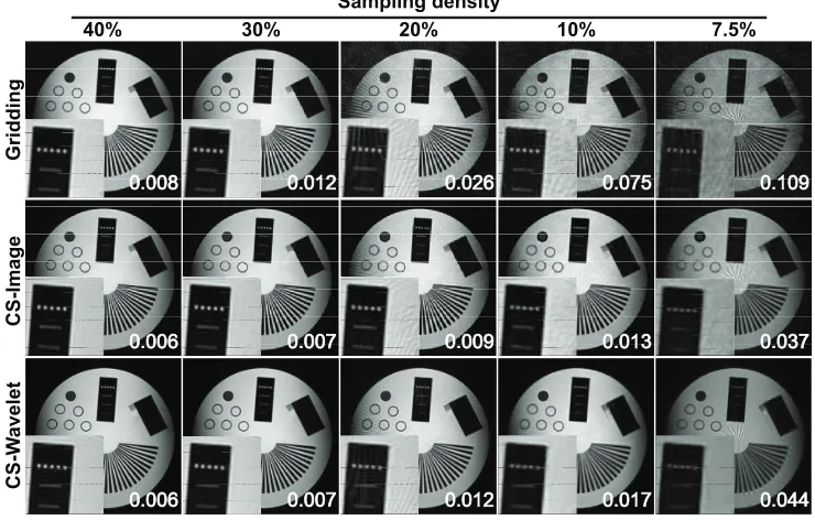 Figure 2.4: Comparison of conventional 3D gridding reconstruction vs. 3D iterativeCS reconstruction with diﬀerent sparsity regularizatuions (image domain and waveletdomain) for a 3D radial acquisition using four diﬀerent sampling densities (40%, 30%,20%, 1