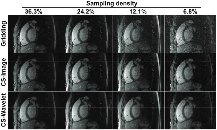 Figure 2.7: Example slices sagittal views from 3D whole-heart images reconstructedby conventional 3D gridding reconstruction and iterative CS reconstruction (with1000 iterations for image domain regularization and 500 iterations for wavelet domainregulariz
