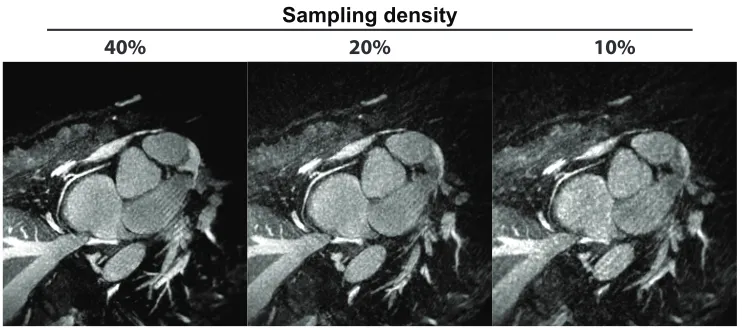 Figure 2.9: Reformatted images of the RCA with isotropic resolution of (1.0mm)3from whole-heart 3D radial data with three sampling densities (40%, 20% and 10%) bythe iterative CS reconstruction with image domain regularization and 1000 iterations.The scan 