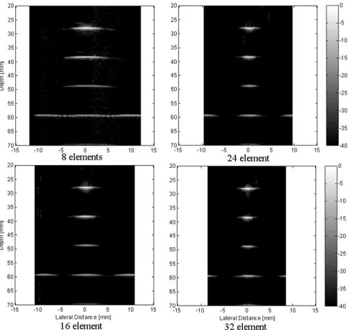 Fig. 6. The artefacts level at the sides of the 40 mm depth scatteringpoint measured when compounding different numbers of angles.
