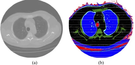 Figure 2. Illustration of the region growing method: a) original image (seed represented by red color), and b) result of the segmentation (red color)
