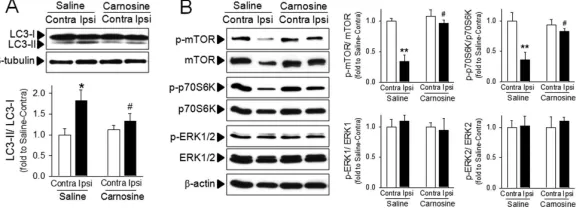 Figure 2. Inhibitory effect of carnosine on autophagy in ischemic brainBrain homogenates were isolated from contralateral (Contra) or ipsilateral (Ipsi) hemispheres from saline- or carnosine (1000 mg/kg; 6 hr post treatment)-administered rats following pMC