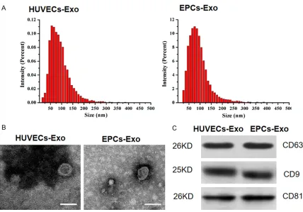 Figure 2. Fluorescence microscopy analysis of Vybrant DiO-labeled HUVECs-bar: 50 Exo and EPCs-Exo internalization by HUVECs
