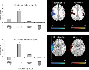 Figure 8. Overlay of connectivity analyses and lesion overlap analysesFunctional connectivity analyses were conducted on the event related fMRI data
