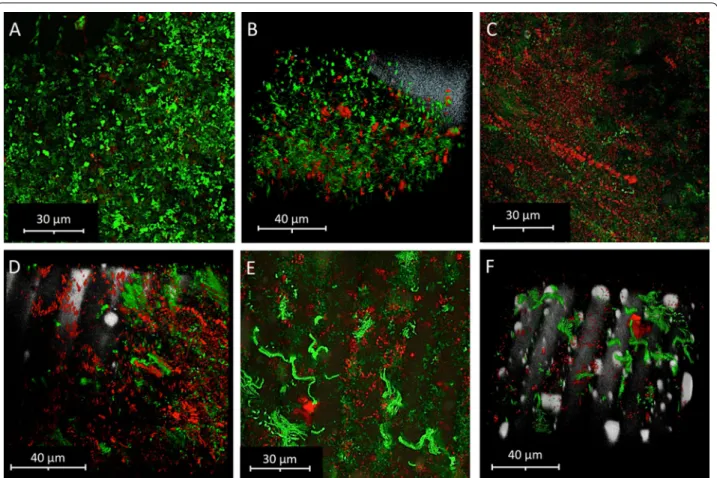 Fig. 3  Micrographs of differential staining and confocal laser scanning microscopy. A, B Untreated controls; C, D Maltodextrin-treated samples; E, F 