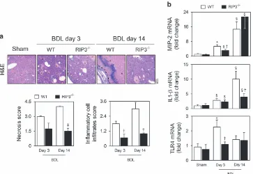 Figure 3RIP3 deficiency ameliorates hepatic necroinflammation in the BDL murine model