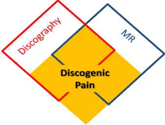 Figure 4. Diagnosing discogenic pain: a chal- lenging process.  