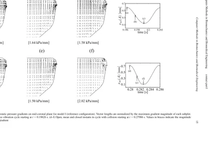 Figure 12.Instantaneous vectors of hydrostatic pressure gradients on mid-coronal plane for model I (reference conﬁguration)