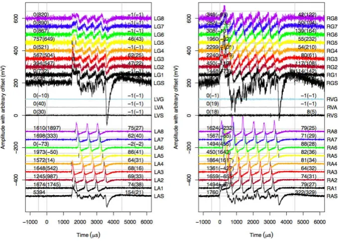 Figure 8. A typical GPCC event, in which a distinct alpha signal is seen on both MWPCs