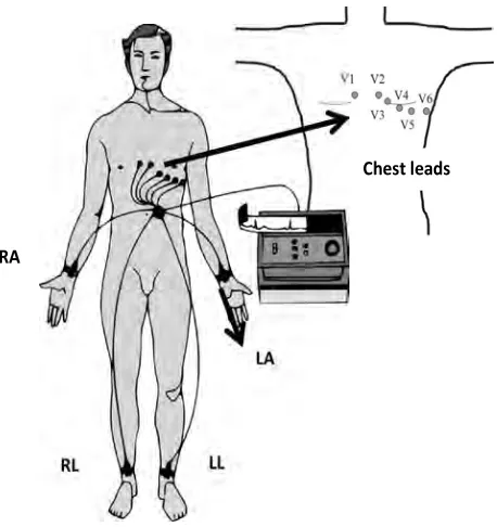 Figure 2.7: Standard 12-lead ECG placement (Adapted from [43]).