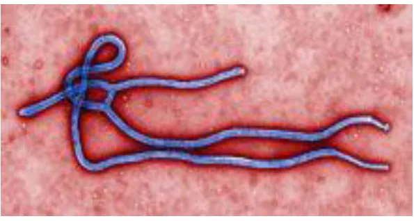 Figure 1: Ebola virus. 