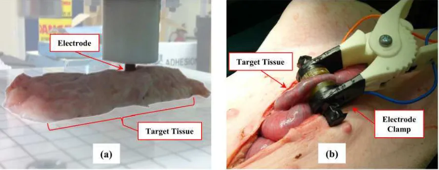 Figure 2. (a) Ex vivo testing on porcine colon tissue showing vertically applied tissue strain