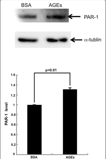 Figure 5 Western blot analysis for PAR-1. HUVECs were treated with or without 100 μg/ml AGE-BSA or 100 μg/ml non-glycated BSA for 4 hr