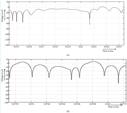 Figure 9. L-G and N-G voltage from inverter with PI controller. (a) Line-ground voltage; (b) Neutral-ground voltage