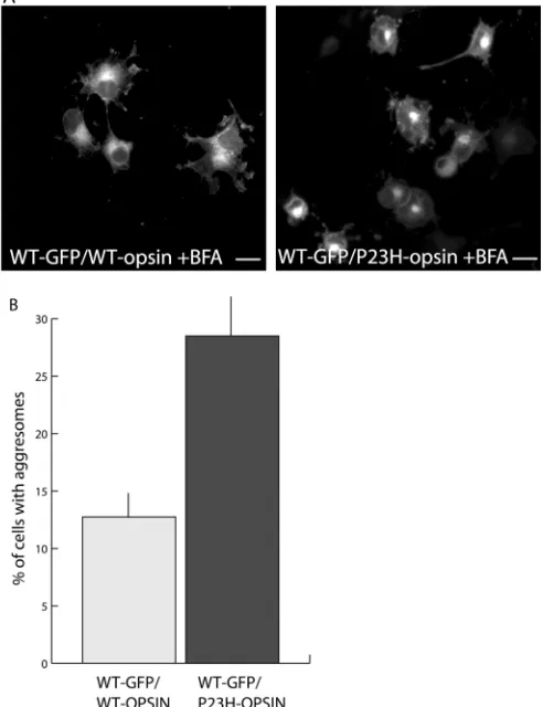 Fig. 4. Ultrastructure of opsin aggresomes. Electronmicrograph of a COS-7 cell with a P23H-GFP mutantaggresome