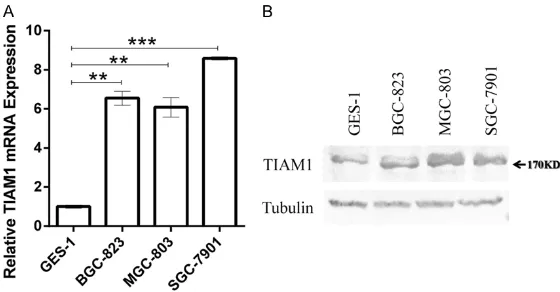 Figure 1. TIAM1 expression levels increased in gastric cancer (GC) cells (BGC823, MGC803, and SGC7901) compared to normal gastric epithelial cells (GES-1) both at mRNA (A) and protein (B) levels