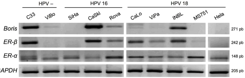 Figure 1. Boris, ER-α, and ER-β mRNA expressions in cervical cancer cell lines by RT-PCR