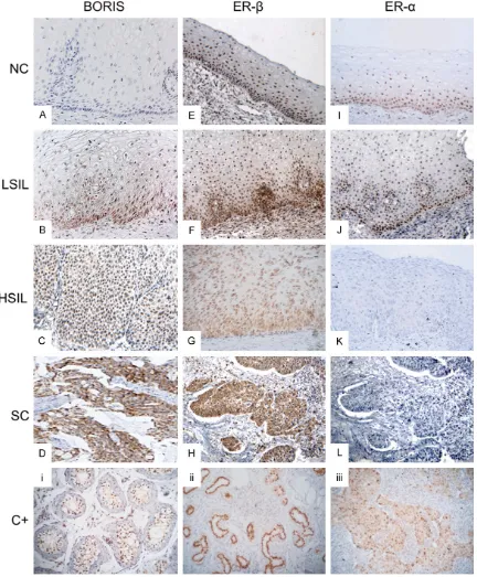 Figure 5. Representative microphotographs of the expressions of BORIS, ER-α, and ER-β in cervical tissues