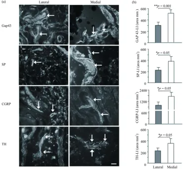 Figure 2(a)Figure 2(b)side compared to the lateral side of the synovium. NPY positive nerve fibres were found as networks around blood vessels