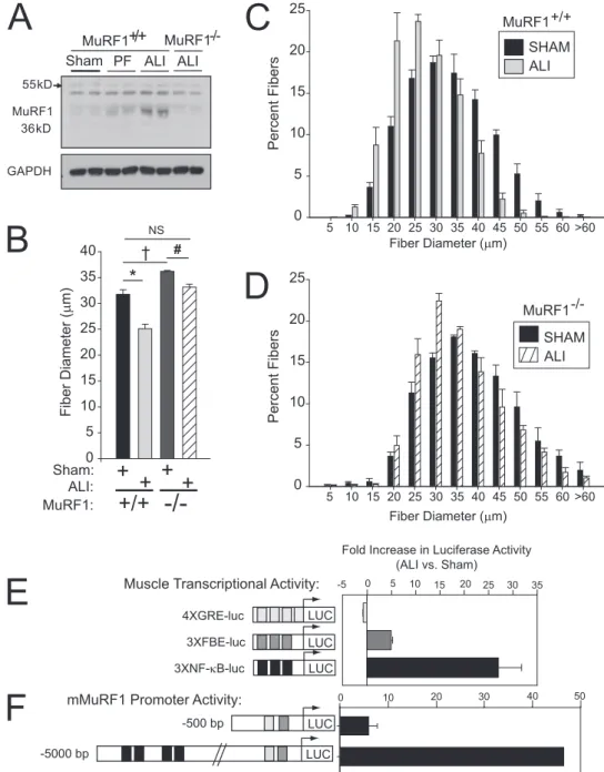 Figure 4. Muscle wasting in muscle ring finger-1 (MuRF1) 2/2 mice and increased nuclear factor (NF)-kB activity in acute lung injury (ALI) wild-type (WT) mouse muscles