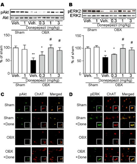 Figure 2. Effects of donepezil on phosphorylation of Akt and staining in the medial septum for phospho-ERK (green), ChAT (red), and merged images