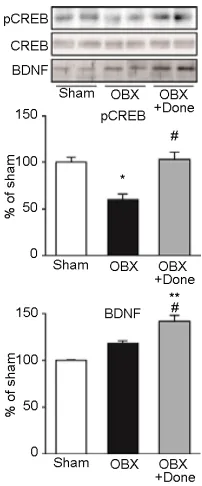 Figure 5. <  Effects of done-pezil on CREB phosphory-lation and BDNF expres-sion in OBX mouse medial septum