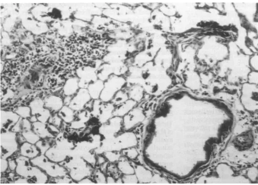 Figure 1. Histologic examination of lungs from rat 7 days after  air-way instillation of P