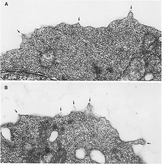 Figure  6.  Immunoelectron 