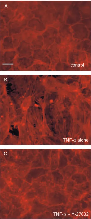 Figure 5. Rhodamine-phalloidin staining of endothelial cell monolayer. (A ) Control cells showing characteristic peripheral bands and close cell–cell contact