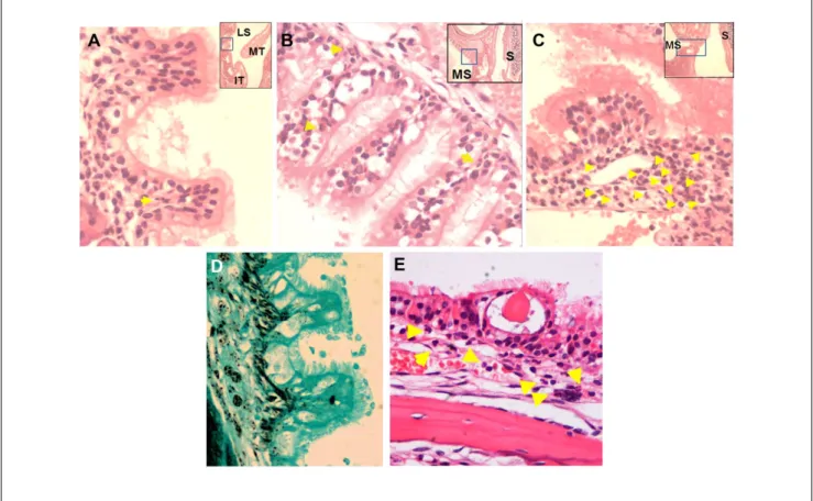 Figure 2.  Nasal polyps in the lateral and maxillary sinuses of OVA-treated wild-type mice