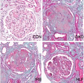 Figure 2. Masson staining of pathomorphologic changes in kidney tissues of different groups (400×).