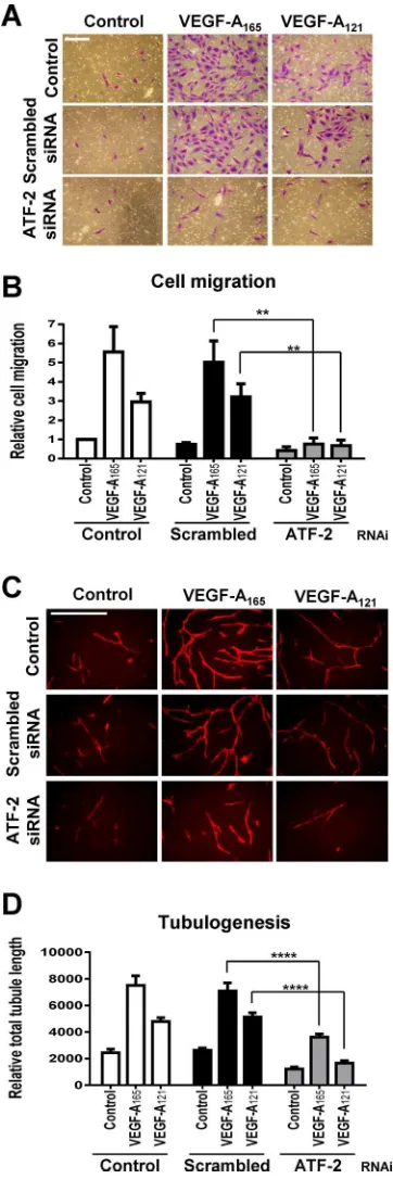 FIGURE 6: VEGF-A and ATF-2 regulation of endothelial cell responses. (A–D) Control, scrambled, or ATF-2–speciﬁc siRNA duplex–treated endothelial cells were seeded into different assays and stimulated with 0.25 nM VEGF-A165 or VEGF-A121 and assessed for end