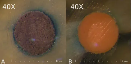 Figure 2. 40× magnification images of a Resilon/Epiphany specimen (A) showing a score 4 circumferential dye penetra-tion, and a gutta-percha/Pulp Canal Sealer specimens (B) show-ing a score 1 circumferential dye penetration