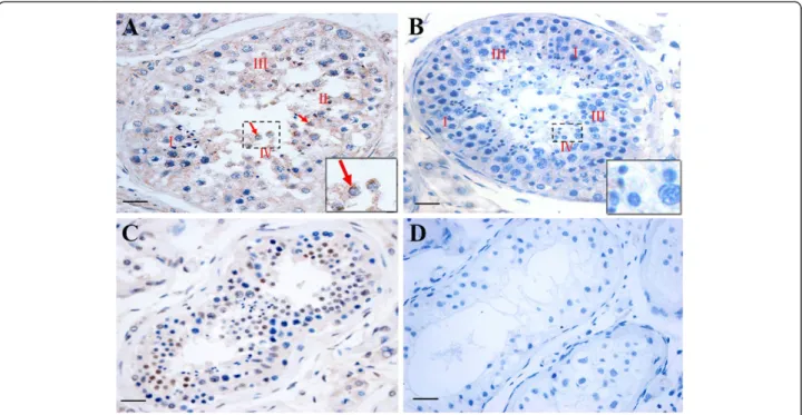 Figure 6 Localization and expression characteristics of DKKL1 protein in the testis of fertile and infertile patients by