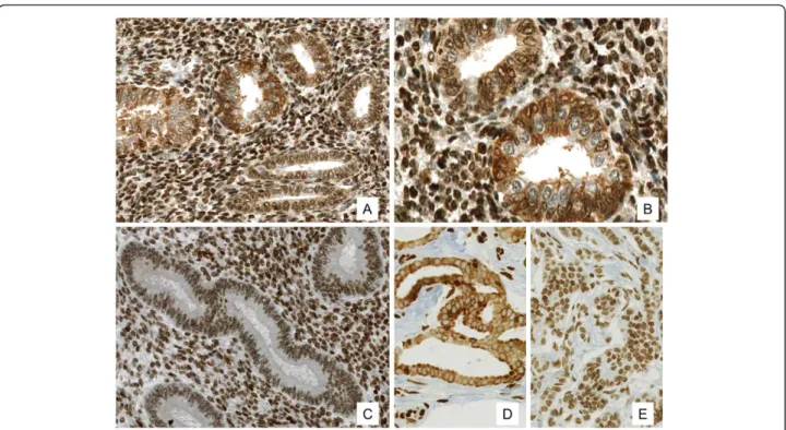 Figure 3 Expression of the G protein-coupled estrogen receptor (GPER) in endometriosis, in normal endometrium and in the positive control